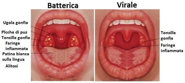 Virus vs Batteri